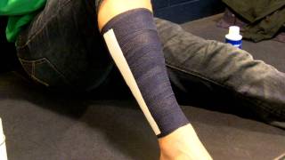 Shin Splint Taping [upl. by Janeen]