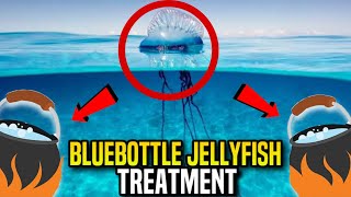 Bluebottle Jellyfish Stings What You Need to Know amp How to Treat Them [upl. by Hplodnar570]