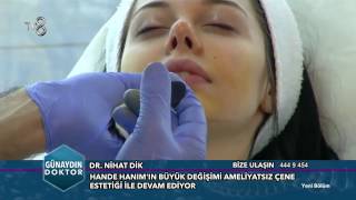 Ameliyatsız Burun Estetiği Aquafilling Dolgu  Dr Nihat Dik [upl. by Humble]