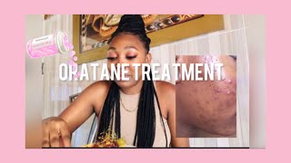 My Oratane journeyHow I cleared my acneamp side effects Clear skin South African YouTuber [upl. by Eceinart]