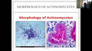 Actinomycetes and Nocardia Diverse Group of Gram Positive Bacilli [upl. by Isidoro]