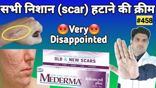 Mederma cream  mederma for acne scars  mederma advanced scar gel review [upl. by Gelb]