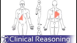 Screening for Visceral Referred Pain in the Thoracic Spine [upl. by Salema986]