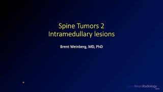 Spine tumors 2 – Intramedullary lesions [upl. by Oiligriv]