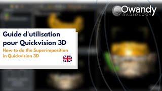 10 How to do the Superimposition in Quickvision 3D [upl. by Annaiv]