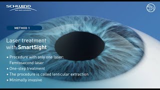 Lenticule extraction quotSmartSightquot with SCHWIND ATOS femtosecond laser [upl. by Laidlaw718]