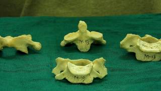 Vertebrae  How to differentiate them [upl. by Ecyoj635]