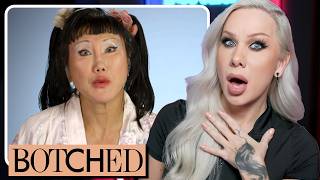 BOTCHED Can transracial plastic surgeries be reversed volume 1 [upl. by Iila]