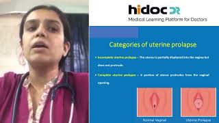 Stages of Uterine Prolapse  By Dr Archana Kamath [upl. by Anital]