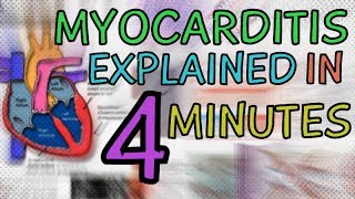 WHAT IS MYOCARDITIS MYOCARDITIS EXPLAINED IN 4 MINUTES  CAUSES SYMPTOMS DIAGNOSIS TREATMENT [upl. by Peers284]