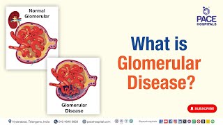 Glomerular Disease  What is Glomerular Disease glomerular shortsvideo youtubeshort viralshort [upl. by Antonius382]