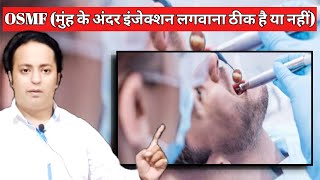 OSMF treatment in India in Hindi। Treatment of Redused Mouth Opening [upl. by Amsirac]