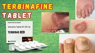 Terbinafine Tablet  Terbinafine Antifungal Drug  Terbinafine Tablets ip 250 mg [upl. by Yelda]