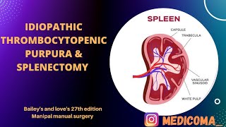 IDIOPATHIC THROMBOCYTOPENIC PURPURA  Etiology Types Clinical Features investigation Treatment [upl. by Lurie]