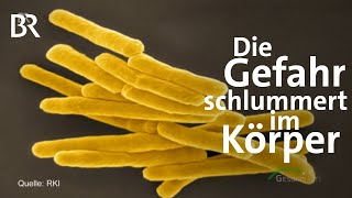 Tuberkulose Erreger schlummert jahrelang im Körper  Gesundheit  BR [upl. by Yatnod823]