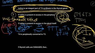 Amiodarone induced Thyroid Disease USMLE essential thyroid video part 3 [upl. by Anire]