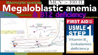 Megaloblastic anemia Vitamin B12 Cobalamin deficiency in HindiUrdu by first aid for USMLE step 1 [upl. by Sybyl]