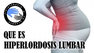 Hiperlordosis lumbar que es y porque se produce [upl. by Channa]