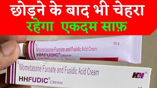 HH Fudic cream  Uses benefits Side effects  For Clean face remove pimple amp acne  Hindi [upl. by Sarazen559]