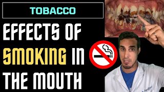 Harmful effects of smoking on body [upl. by Anirbed201]