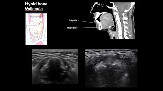 ENGNeck anatomy 1center [upl. by Jeana62]