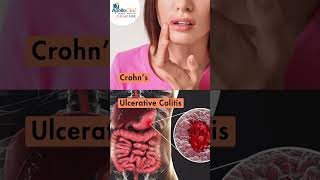 Understanding Inflammatory Bowel Disease Part 1  Apollo Clinic Chinar Park viralreels [upl. by Alastair401]