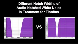 Notched Audio White Noise Sampler of Different Notch Widths in the Treatment for Tinnitus [upl. by Kcirddor]