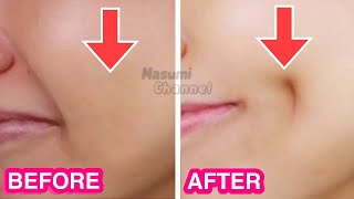 How To Get Dimples Fast amp Naturally Simple Facial Exercises to get Dimples without Surgery [upl. by Necaj217]