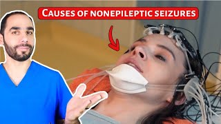 Causes of Nonepileptic Seizures PNES Hint NOT Stress [upl. by Natam746]