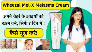 Wheezal MelX Cream Uses in Hindi  Wheezal MelX Cream Review  Mel X Cream  Mel X Melasma Cream [upl. by Anadroj]