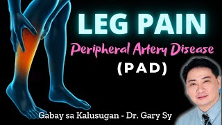 Leg Pain Peripheral Artery Disease PAD  Dr Gary Sy [upl. by Laicram610]