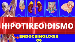 HIPOTIREOIDISMO CAUSAS SINTOMAS DIAGNÓSTICO E TRATAMENTO  ENDOCRINOLOGIA [upl. by Namijneb126]