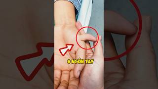 Tại Sao Lại Có 6 Ngón Tay 😲  giải thích  facts amazingfacts [upl. by Inele]