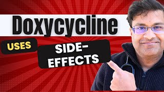 Your guide to Doxycycline uses and side effects [upl. by Elysee]