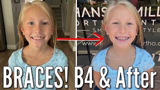 Shes Getting Braces  8 Year Old Goes to the Orthodontist to Get Braces Put On [upl. by Iral]