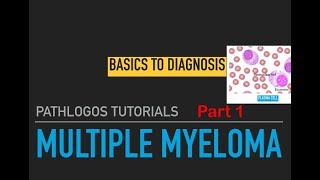 Multiple myeloma Pathology lecture Part 1 [upl. by Gnay196]