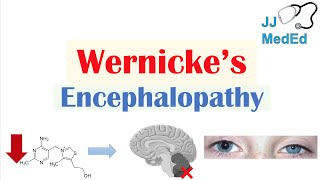 Wernicke’s Encephalopathy  Causes Symptom Triad amp Treatment [upl. by Aimac]