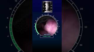 Inside the Womb  Fetal Growth of a Baby WeekbyWeek  नौ महीने का अद्भुत जीवन😇 baby development [upl. by Attennhoj]