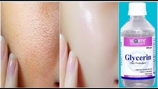 Use Glycerin This Way Your Skin Will Look So Young Tight Spotless amp Scar Free [upl. by Lalittah]