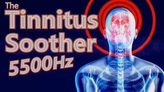 Tinnitus Soother is MidRange Focused 5500Hz Noise [upl. by Luckett81]