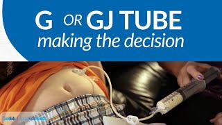 The GGJ Tube Decision [upl. by Lamek65]