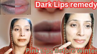 No more DarknessDark Lips Remedy2 ways to Prevent from Lips tanning amp darkness aliyanalizafamily [upl. by Colston]