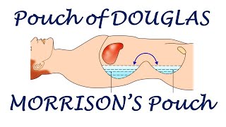 Chp18  Special Regions of Peritoneal Cavity  Pouch of Douglas  HepatoRenal Pouch  BDC Vol2 [upl. by Camilla]