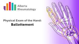 Rheumatology HAND exam Palpation for Joint Swelling [upl. by Anahsal282]