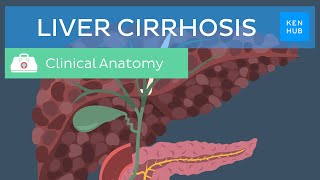 Liver cirrhosis Definition pathology diagnosis treatment and prevention  Kenhub [upl. by Oinigih794]