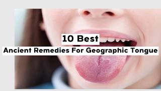 10 Ancient Remedies For Geographic Tongue [upl. by Monie]