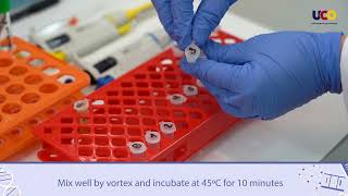 Quantitative analysis of proteins by the Lowry method [upl. by Harrat]