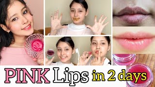 In 2 Uses💋  Black Pigmented Lips to Naturally Pink💋 100 works  My Lip Care ROUTINE  Soft lips [upl. by Thurber]