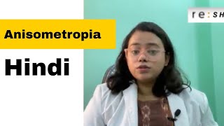 Anisometropia  Anisometropic Amblyopia  Hindi [upl. by Candida]