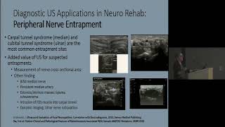 Ultrasound US Applications in NeuroRehab How US Changes Clinical Practice [upl. by Vicki732]